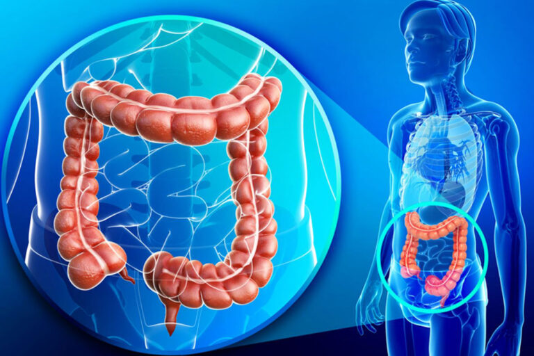 Dysbiosis Treatment