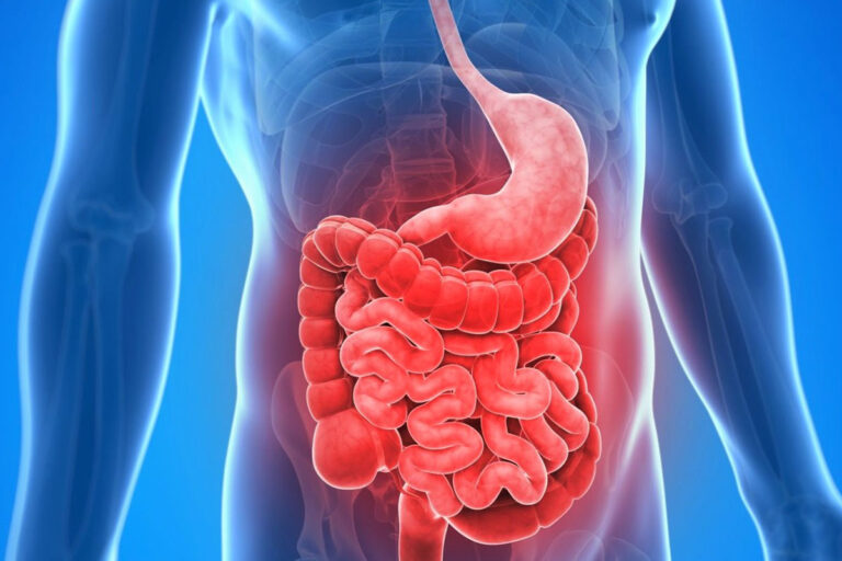 Leaky Gut Syndrome Treatment